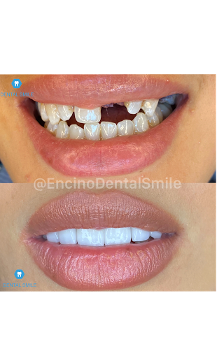 Encino Dental Smile image
