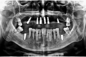 Çene Cerrahisi ve İmplantoloji Uzm. Dr. Erman Şenel Modern Diş Polikliniği image