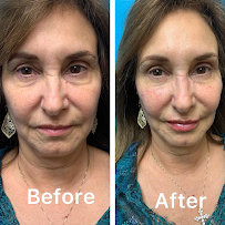 A & I Pure Beauty Med Spa - Photo 7 - Car repair in Webster, TX, League City