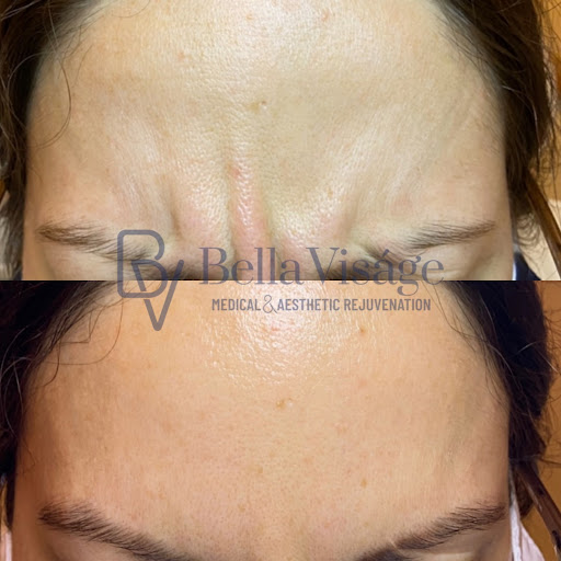 Explore couples small tattoo ideas, creative tattoo ideas in Lakeland, available at Bella Visge Medical & Aesthetic Rejuvenation