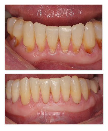 Dentist «Dentistry In Bellevue», reviews and photos