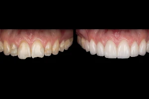 Clear Dental Toronto (Pearlwhite Dental) image