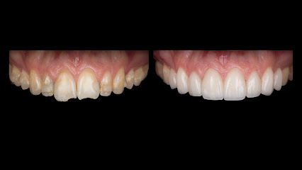 Pearlwhite Dental (Clear Dental Toronto)