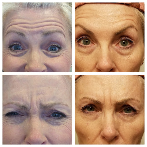 Explore sukuna tattoo ideas, creative tattoo ideas in Eugene, available at Brighter Smiles Med Spa and Laser Center