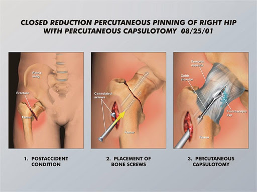 Personal Injury Attorney «Law Offices of James O. Cunningham, P.A.», reviews and photos