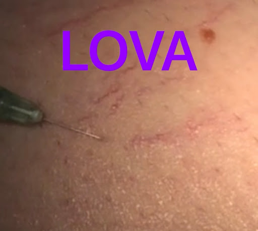 Explore men's ring tattoo ideas, creative tattoo ideas in Lake Oswego, available at Lake Oswego Vein and Aesthetic LOVA