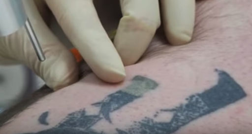 Explore tattoo ideas music lovers, creative tattoo ideas in Englewood, available at Laser Remedy Skin Solutions