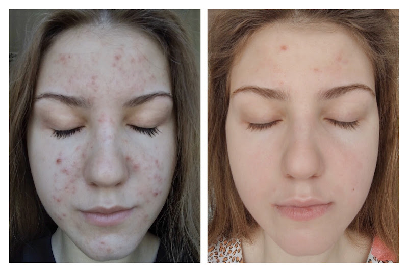 Обладнання клініки Сенсаві