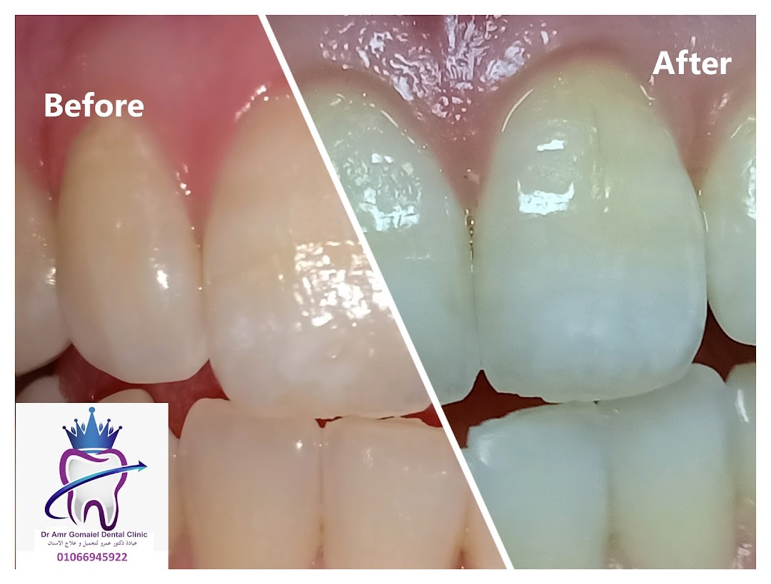 Dr Amr Gomaiel Clinic - عيادة د عمرو محمد عبد العزيز لتجميل و علاج الأسنان