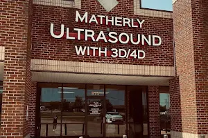Matherly Ultrasound with 3D/4D image