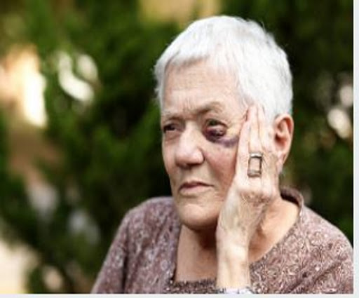 Personal Injury Attorney «Russell & Lazarus APC, Newport Beach Personal Injury Lawyer», reviews and photos