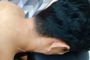 Sambhav Acupuncture & Physiotherapy Clinic image
