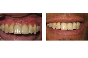 Washington State Prosthodontics image