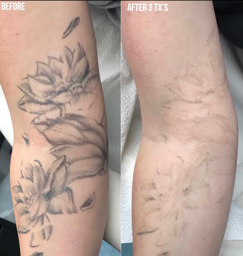 Explore small leg tattoo ideas, creative tattoo ideas in Tucson, available at Allure Medical