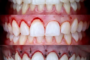 Estética Dental Zale image