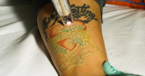 Explore haiti tattoo ideas, creative tattoo ideas in Glenwood Springs, available at Lifestyle Laser