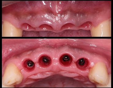 Malligai Dental Hospital - Malligai Dental Hospital