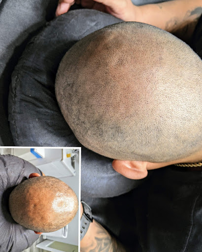 Explore helicopter tattoo ideas, creative tattoo ideas in Roseville, available at NuHair Ink. Scalp MicroPigmentation & Aesthetic Clinic of Sacramento