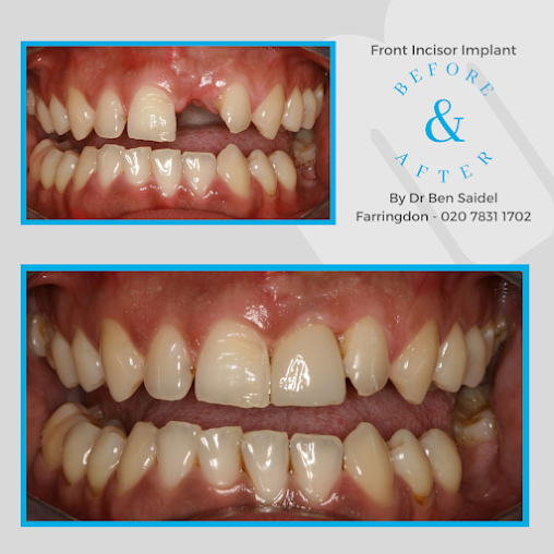 مالمين لطب الأسنان - ليفربول - Malmin Dental - Liverpool