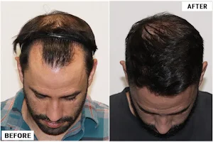 ForHair Hair Transplant Clinic image