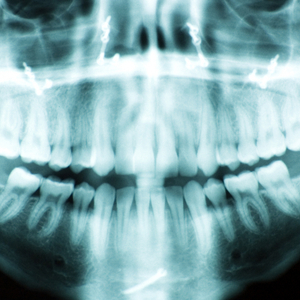 Capstone Dental Care image