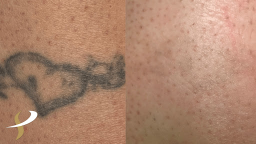 Explore men shoulder tattoo ideas, creative tattoo ideas in Spokane, available at Premier Body and Laser