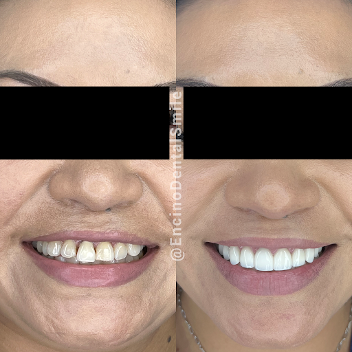 Encino Dental Smile image