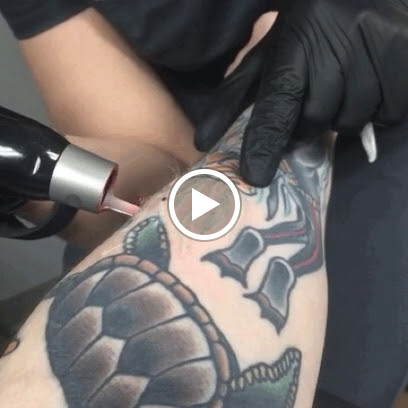 Explore tattoo sleeve ideas womens, creative tattoo ideas in Vienna, available at Removery Tattoo Removal & Fading