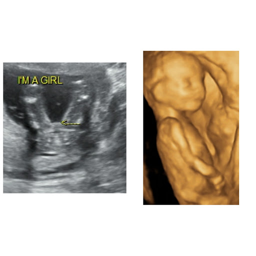 A Little Insight 3D 4D 5D Ultrasound image