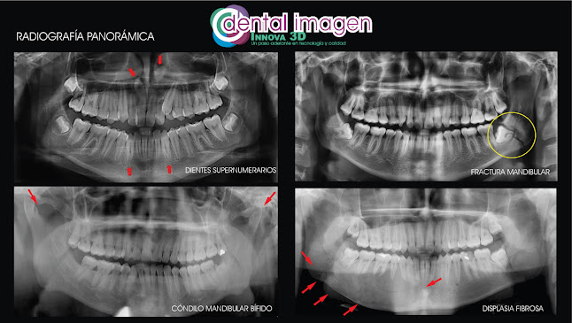 Dental Imagen Innova 3D Centro Radiológico - Dentista