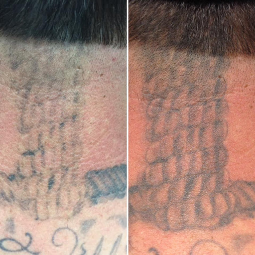 Explore roman numeral tattoo ideas for guys, creative tattoo ideas in South Gate, available at Tattoo Removal Inc