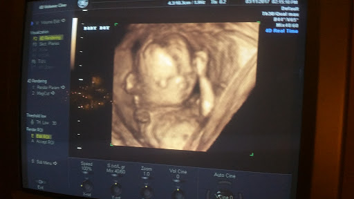 Baby Store «Ideal Baby & Kids - Hialeah», reviews and photos, 1170 W 49th St, Hialeah, FL 33012, USA