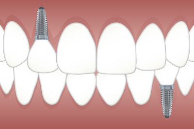 Eloualji Nawaf Dentiste Compiègne à Compiègne
