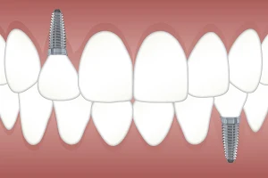 Eloualji Nawaf Dentiste Compiègne image