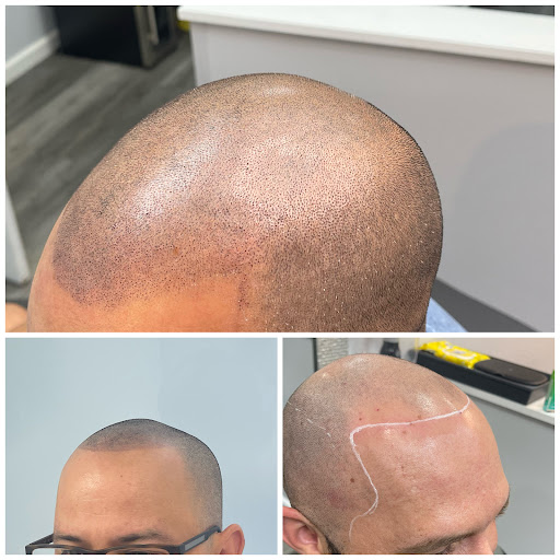 Explore female big tattoo ideas, creative tattoo ideas in Roseville, available at NuHair Ink. Scalp MicroPigmentation & Aesthetic Clinic of Sacramento