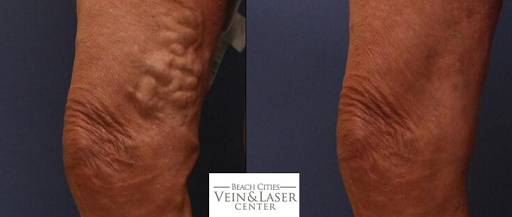 Beach Cities Vein and Laser Center image