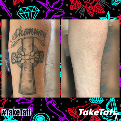 TakeTatt Tattoo Removal