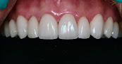 Winningsmiles Custom Dentistry & Implant Center