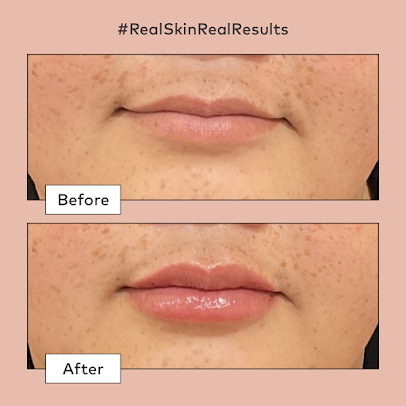 Caci Viaduct - Caci Viaduct