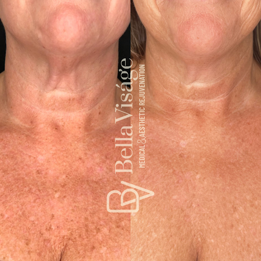 Find web tattoo ideas for your next unique tattoo in Lakeland at Bella Visge Medical & Aesthetic Rejuvenation