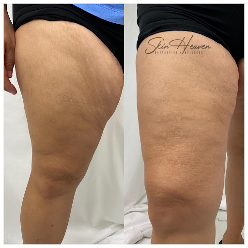 Skin Heaven Aesthetics and Wellness image