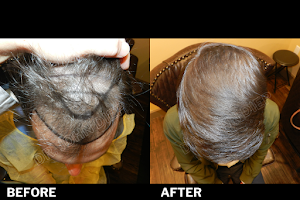 Medical Hair Transplant & Aesthetics image