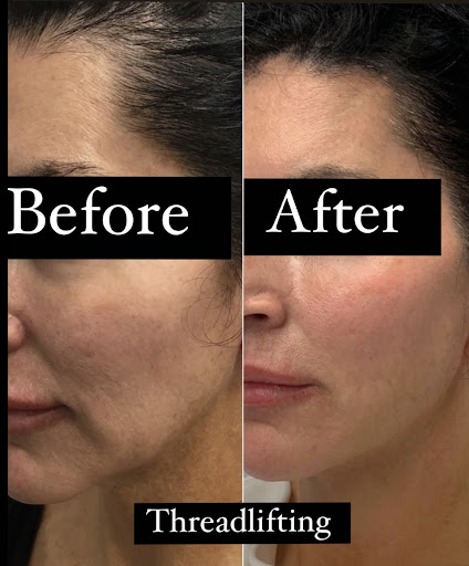 Medical Spa «Lavender Med Spa», reviews and photos, 3675 Crestwood Pkwy #400, Duluth, GA 30096, USA