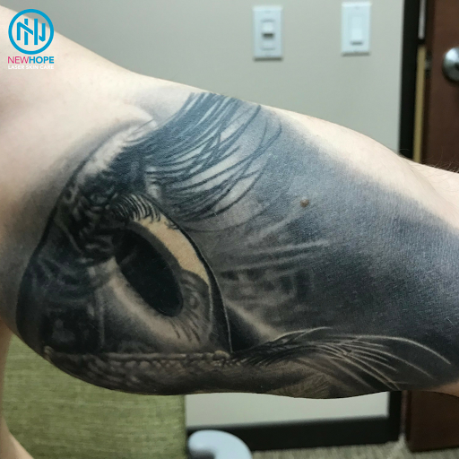 Explore man sleeve tattoo ideas, creative tattoo ideas in Westminster, available at Newhope Laser Skin Care