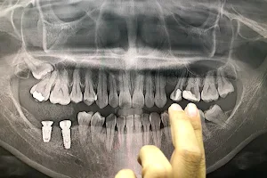 Bangkaew Smile Dental Clinic คลินิคทันตกรรมบางเเก้วสไมล์ รับจัดฟัน ทำรากเทียม ครอบฟัน image