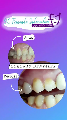 Opiniones de CLINI DENT INDACOCHEA en Guayaquil - Dentista