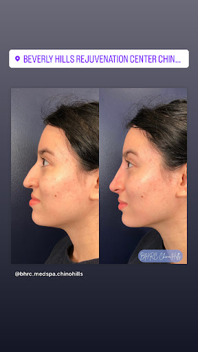 Beverly Hills Rejuvenation Center image