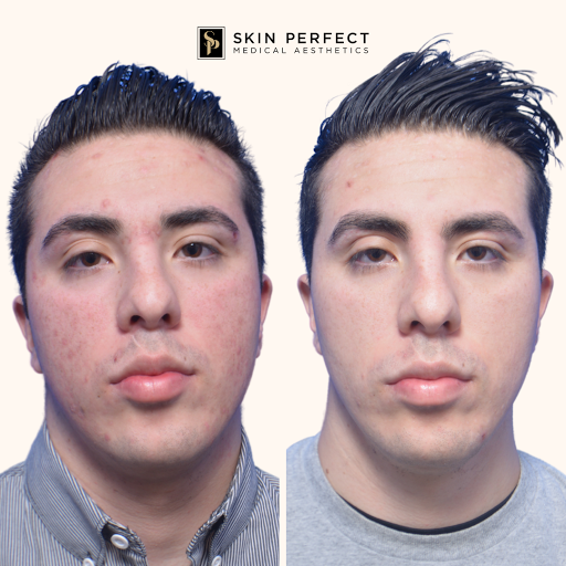 Explore black female tattoos ideas, creative tattoo ideas in Whittier, available at Skin Perfect Medical Aesthetics