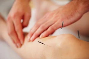 Comal Springs Acupuncture image