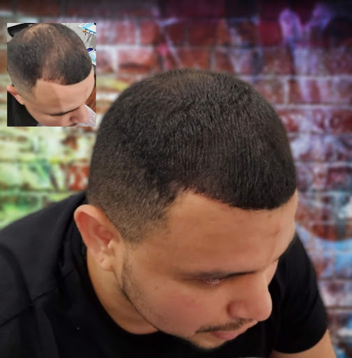 Downey Hair Loss Solutions SMP image